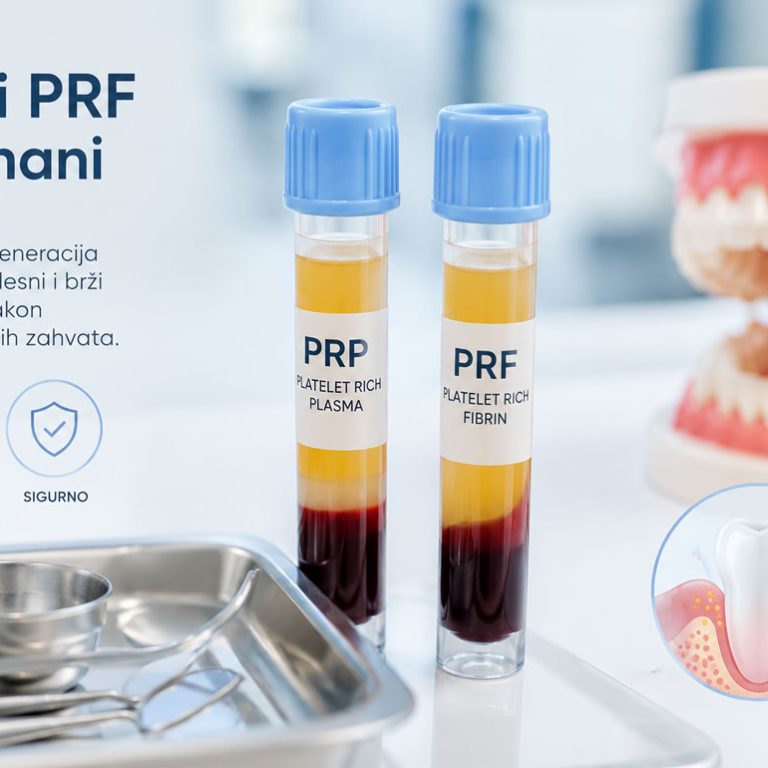 PRP-i-PRF-tretmani